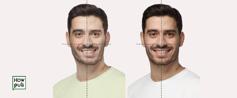 Before and after asymmetrical face treatment