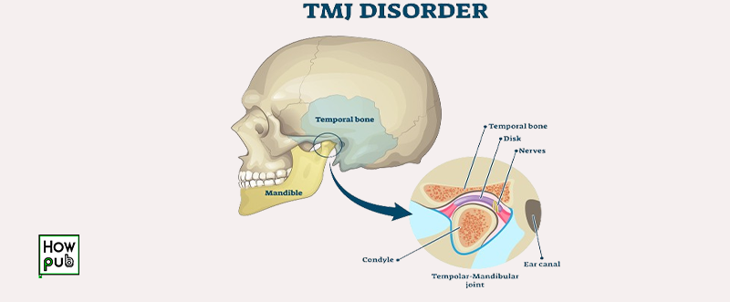 Locked jaw diagram and treatment